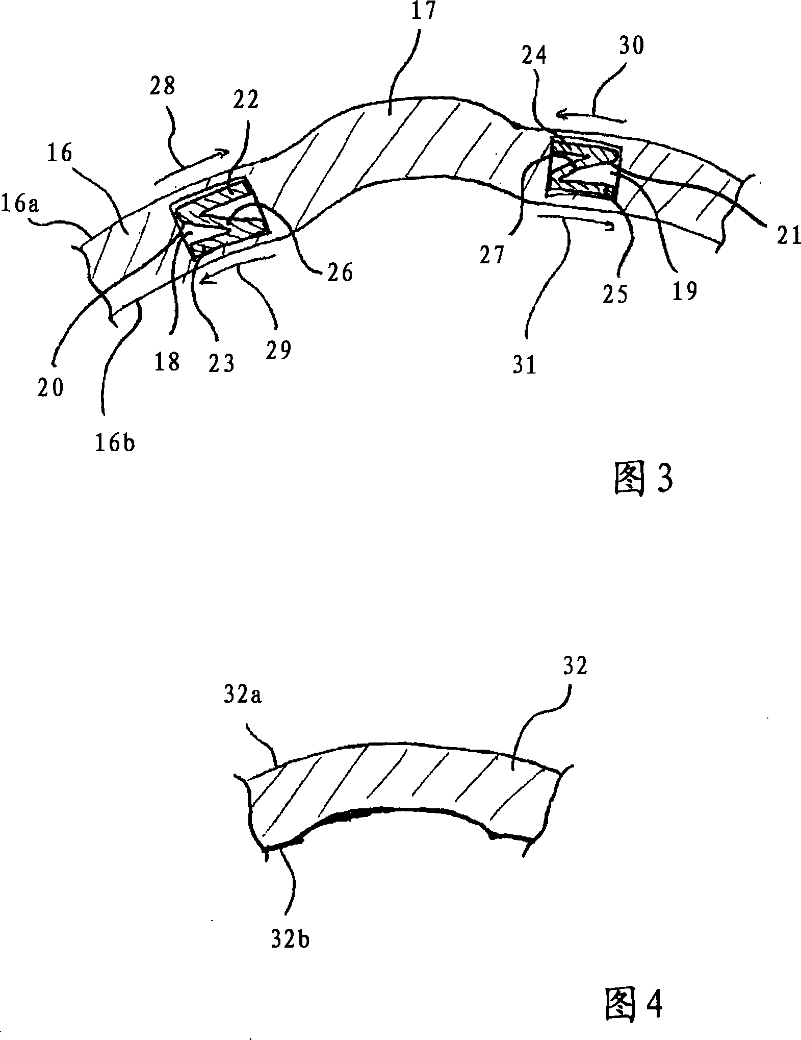 System and device for compensating a local deformation of the cornea of an eye