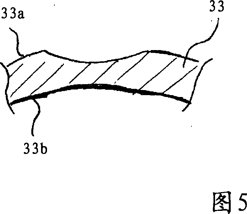 System and device for compensating a local deformation of the cornea of an eye