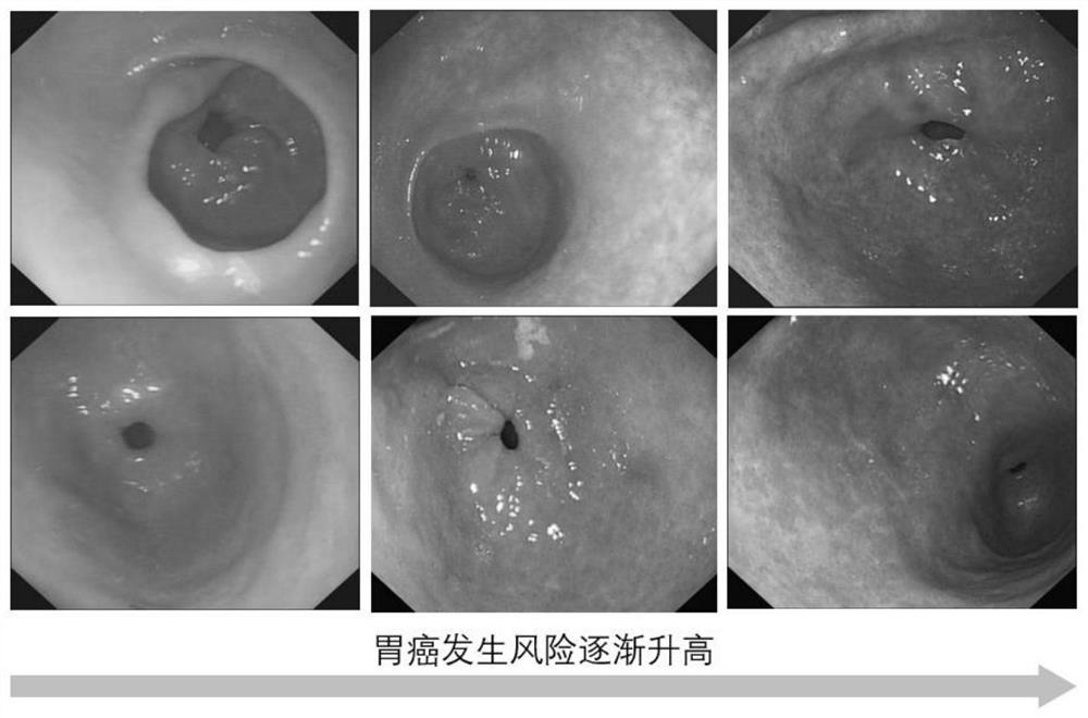 A combination marker and its application in the preparation of gastric cancer risk prediction kit and its measurement system and method