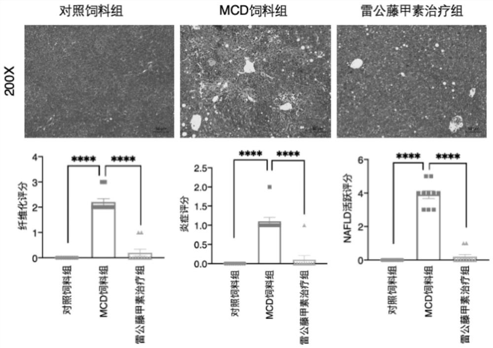 Application of triptolide in preparation of medicine for preventing and/or treating liver diseases