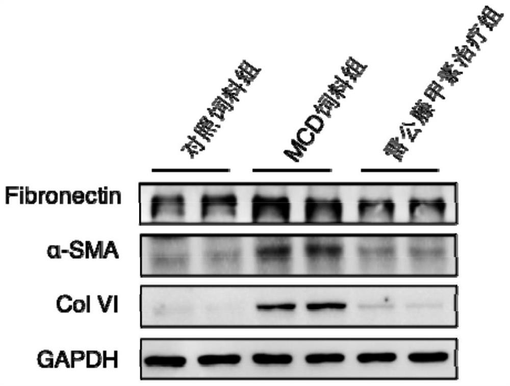 Application of triptolide in preparation of medicine for preventing and/or treating liver diseases