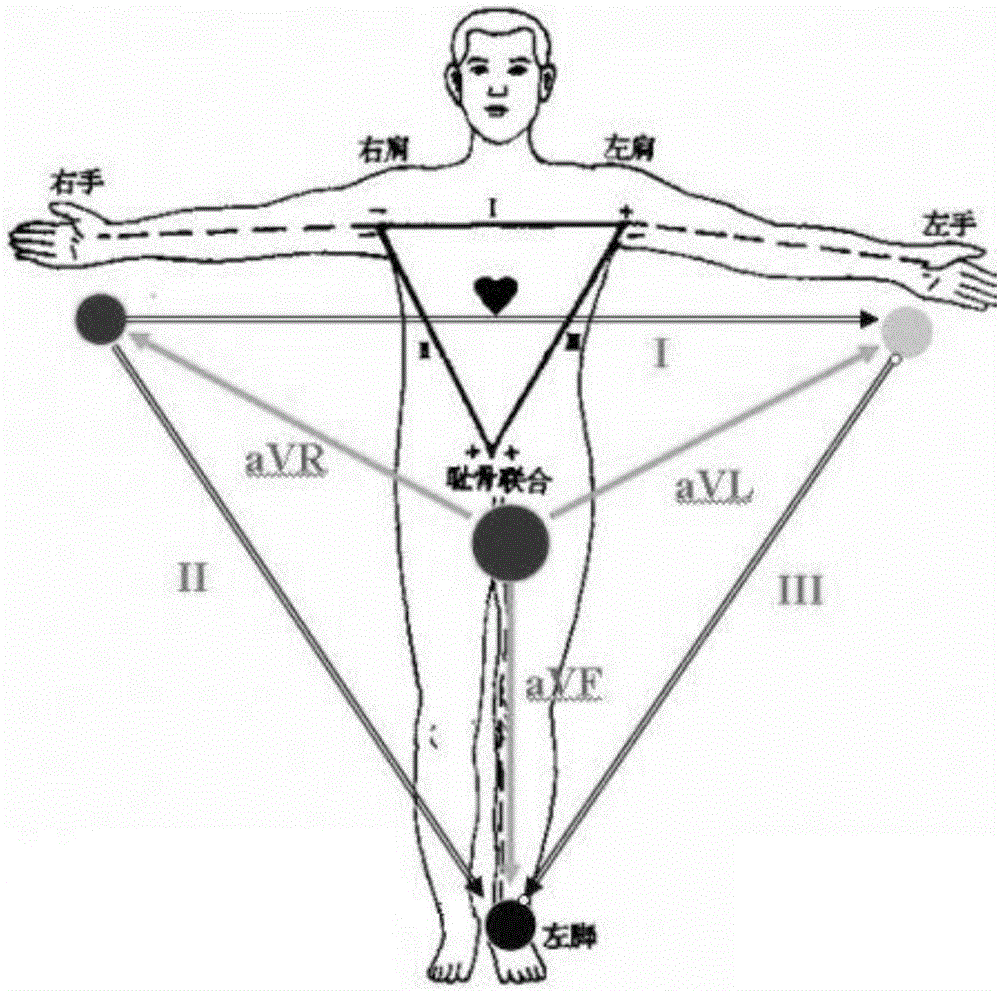 Contact type electrocardiograph signal collecting chair and electrocardiograph signal measuring system