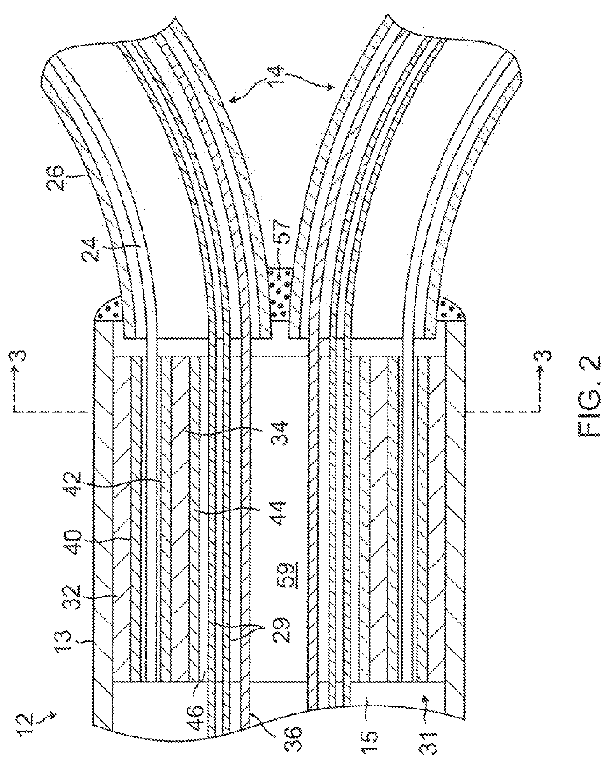 Catheter with multiple spines of different lengths arranged in one or more distal assemblies