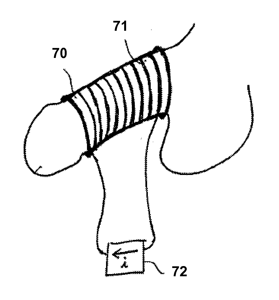 Systems and methods for the treatment of pelvic disorders including magnetic particulates