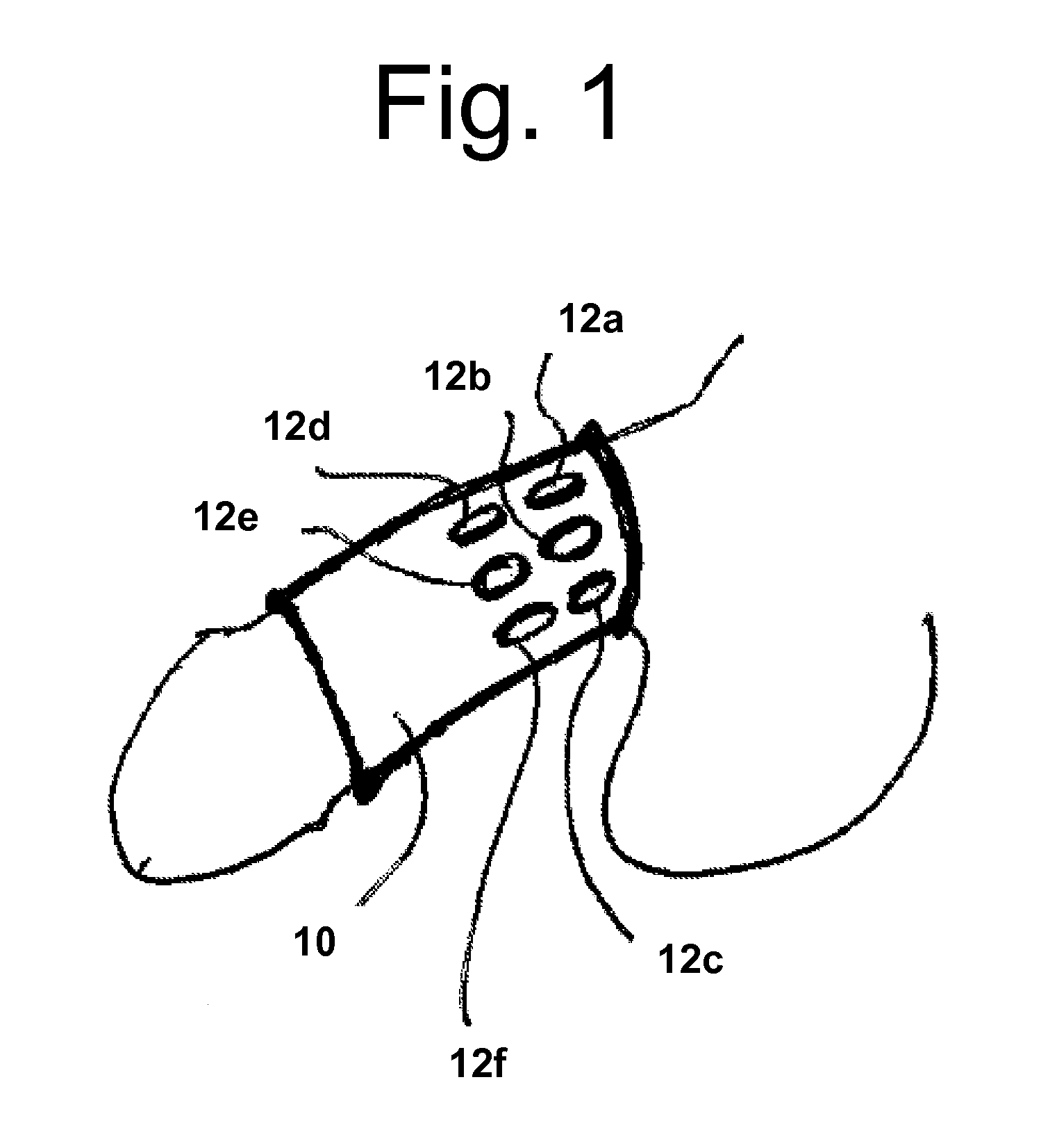 Systems and methods for the treatment of pelvic disorders including magnetic particulates