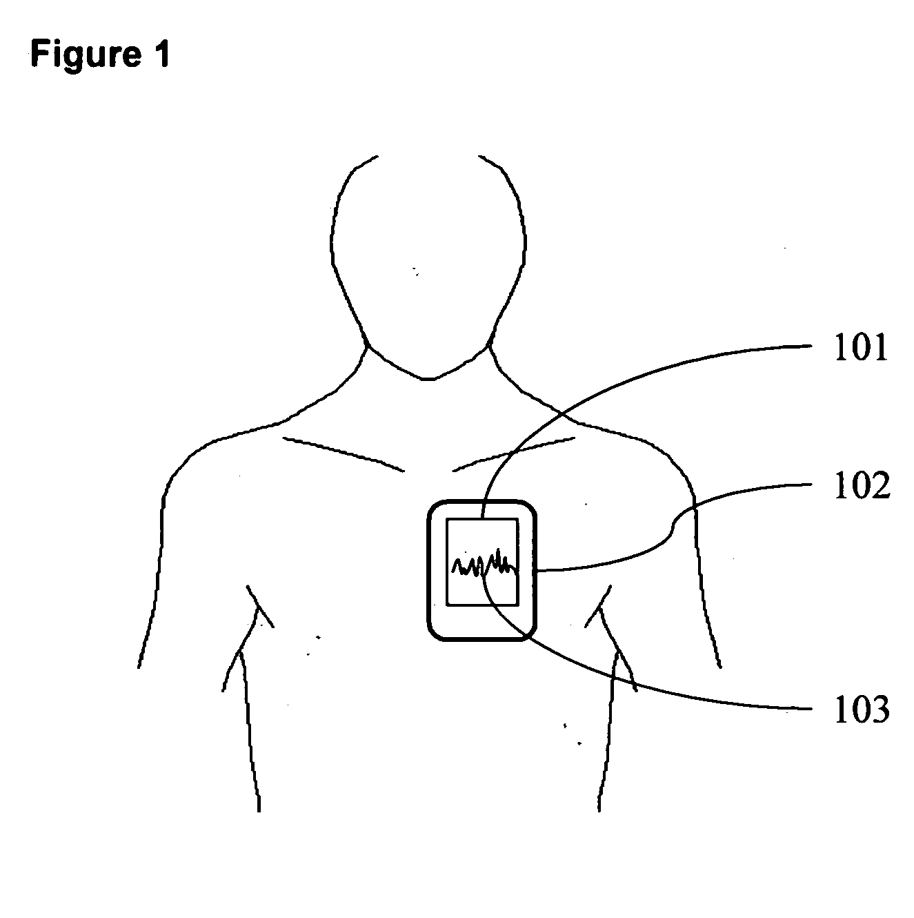 Physiological data recording apparatus for single handed application