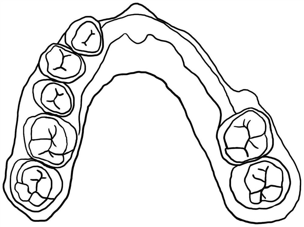 A guide plate for digitally and accurately guiding the preparation process of support recesses and its manufacturing method