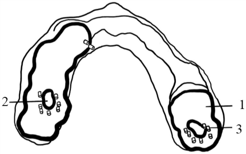 A guide plate for digitally and accurately guiding the preparation process of support recesses and its manufacturing method