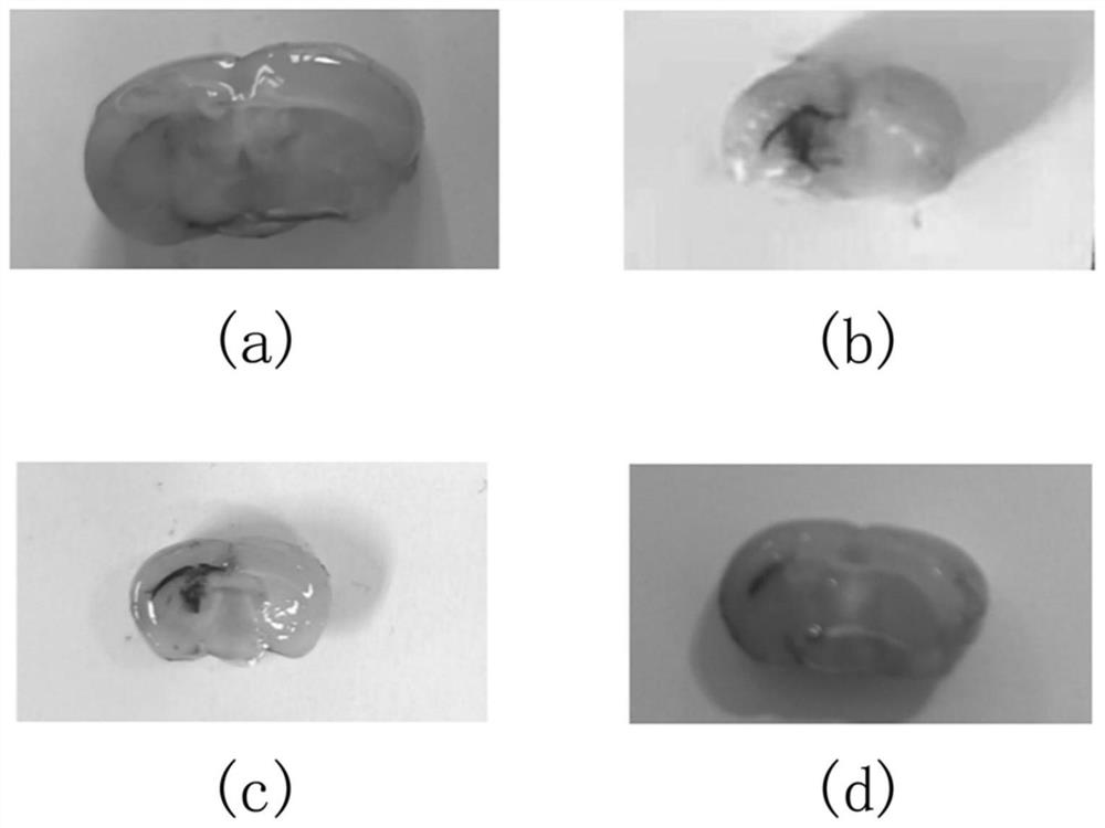 Modeling method of mouse hypertensive cerebral hemorrhage model