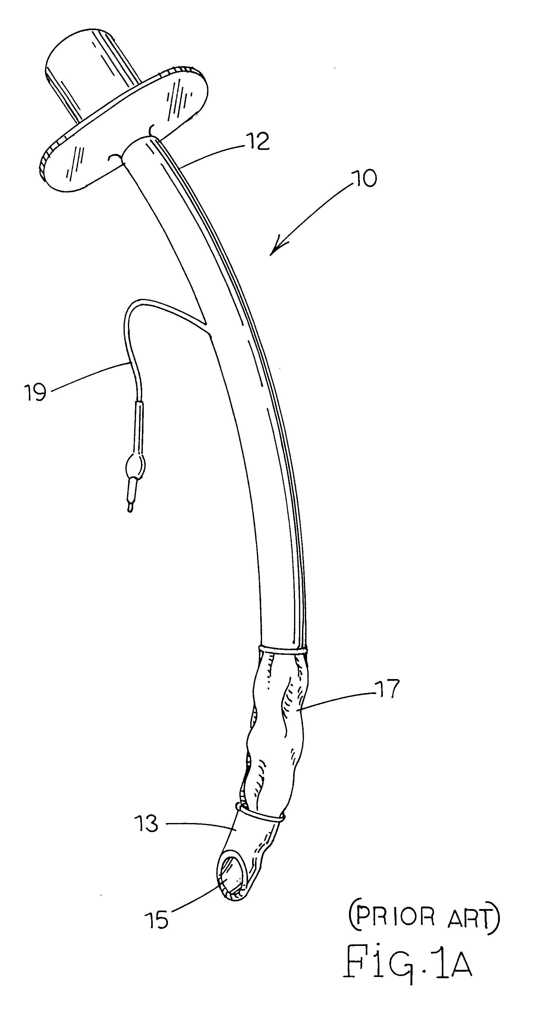 Separable double lumen endotracheal tube
