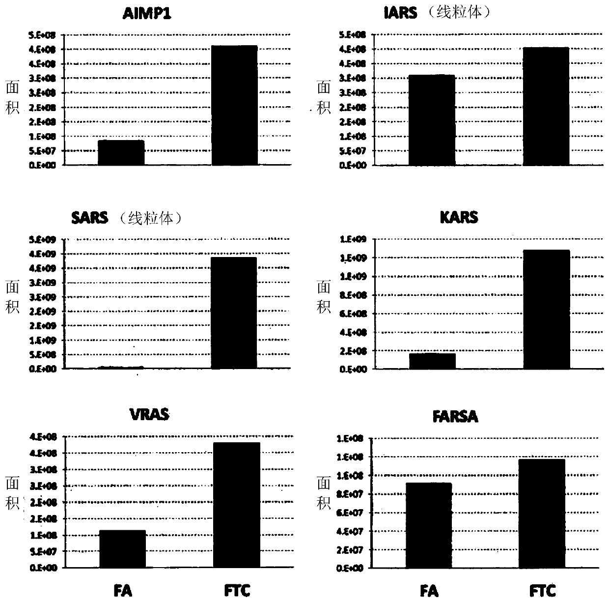 Method for detecting diagnostic marker of follicular thyroid carcinoma using expression level of aminoacyl-trna synthetase-related protein