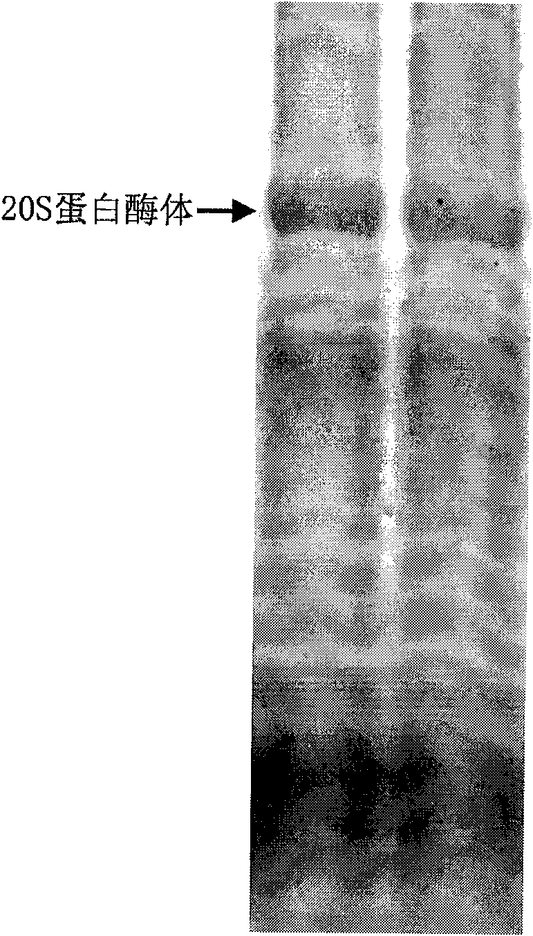 Protein complex or compound three-dimensional gel electrophoresis separating method