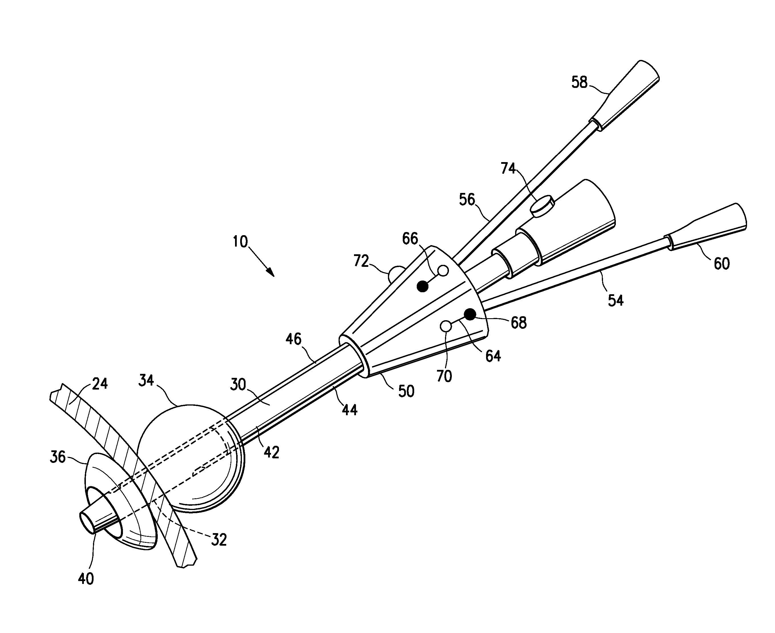 Apical Instrument Port