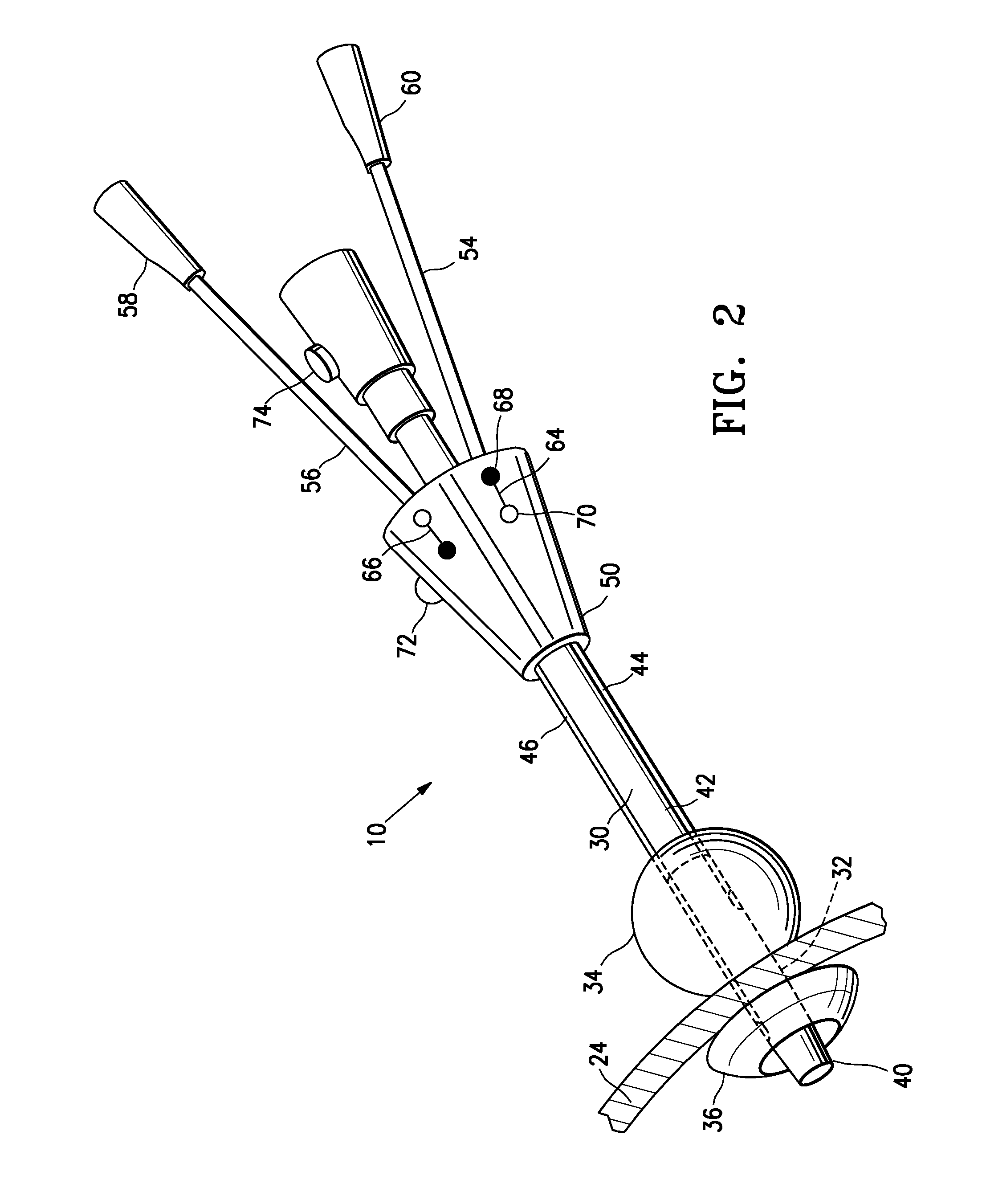 Apical Instrument Port