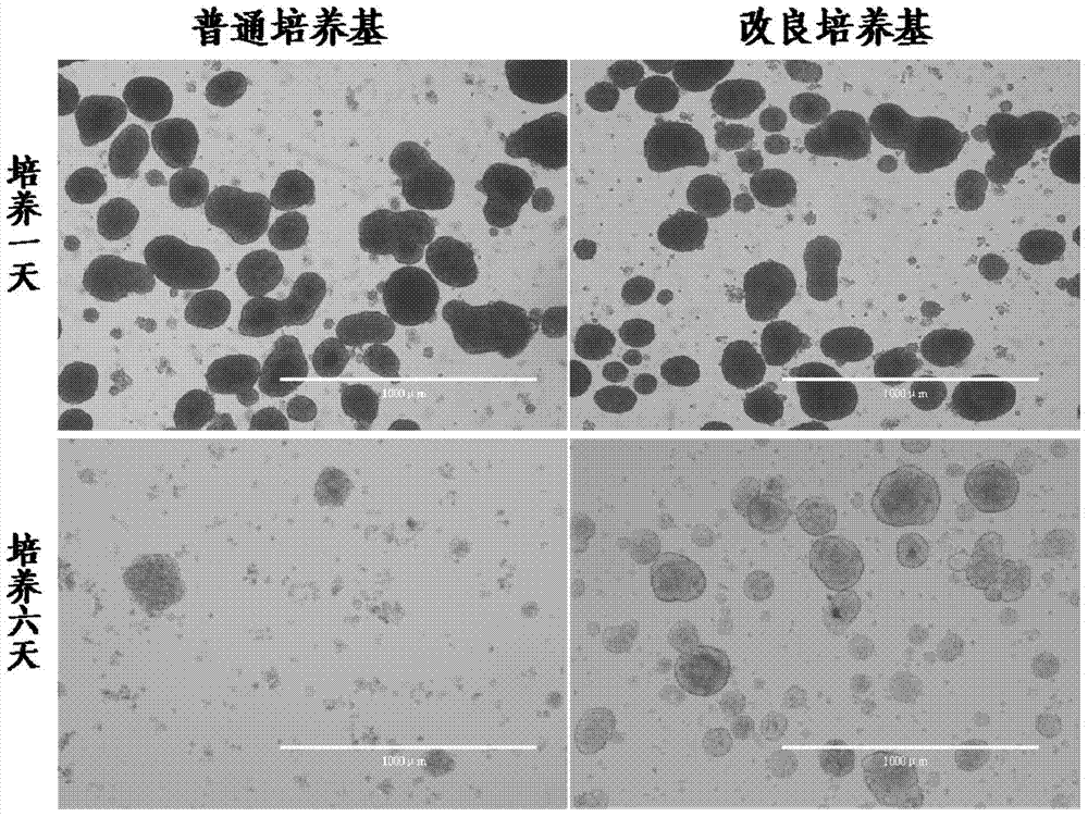 Improved culture medium for neonatal pig islet cells and use method of same