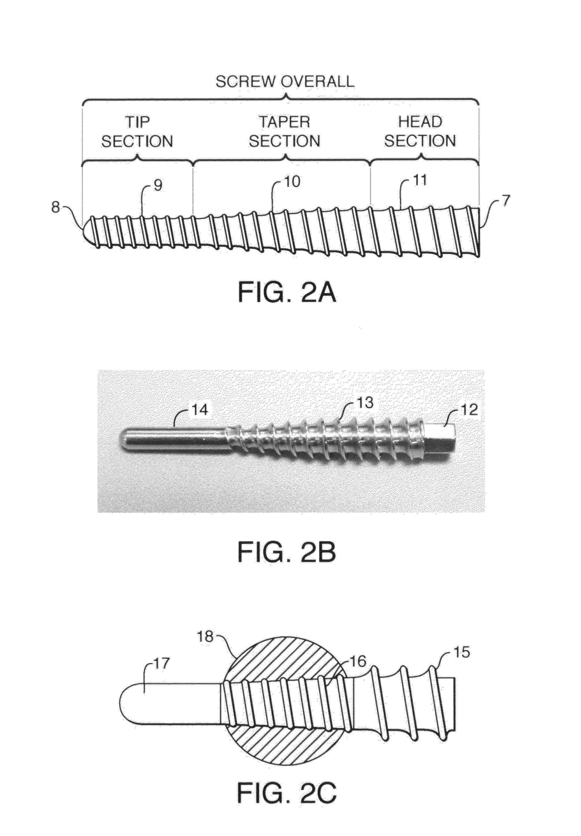 Devices and methods for interlocking surgical screws and nails