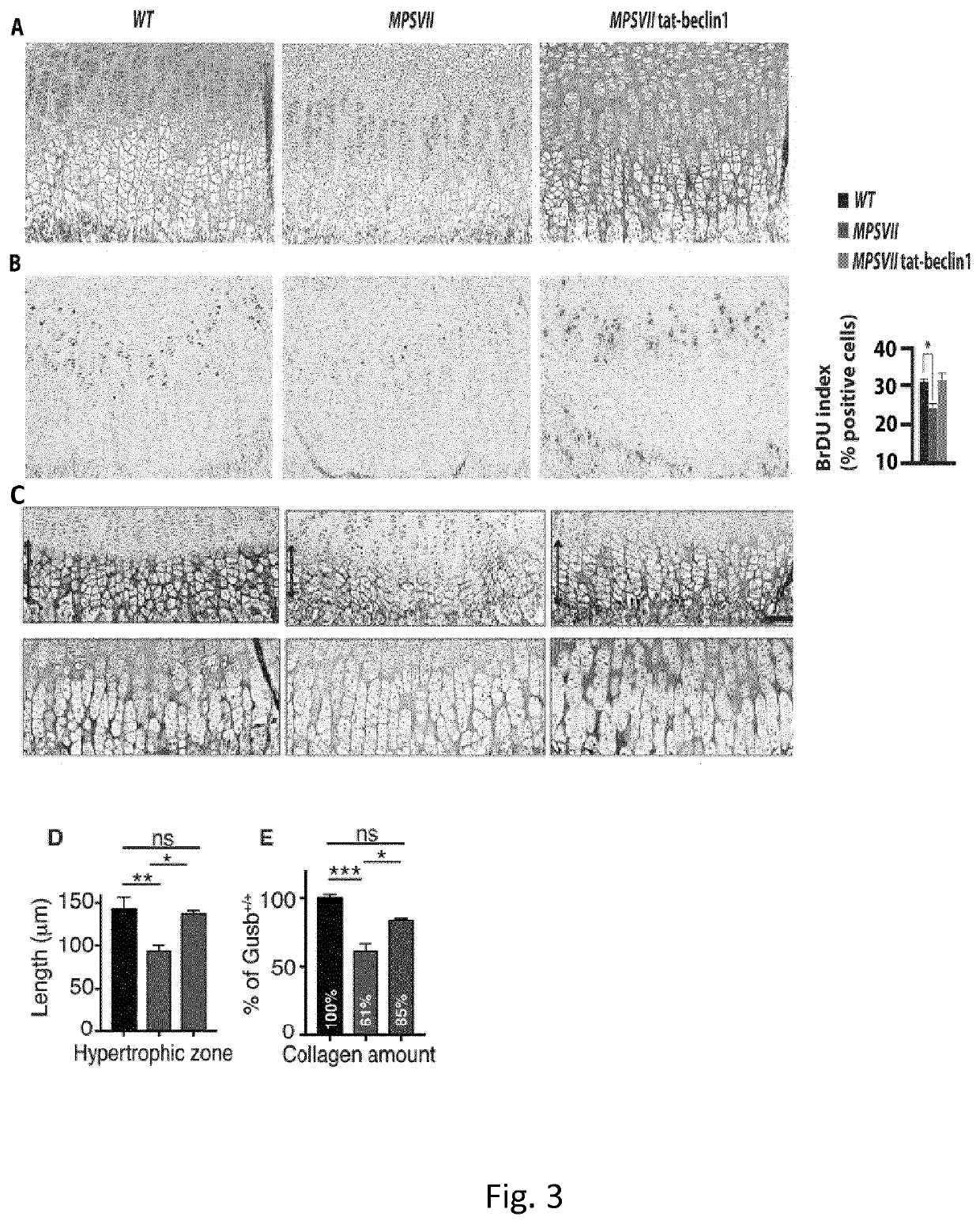 Treatment of bone growth disorders