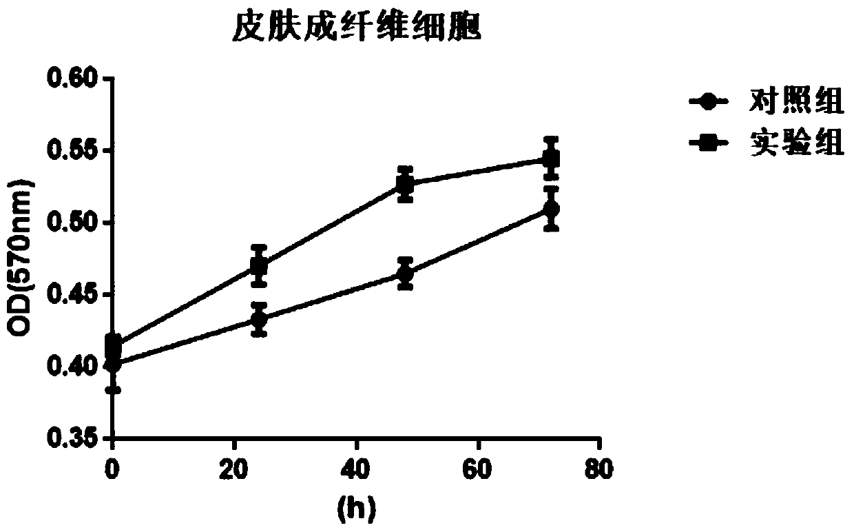 Umbilical cord mesenchymal stem cell preparation and preparation method and application thereof