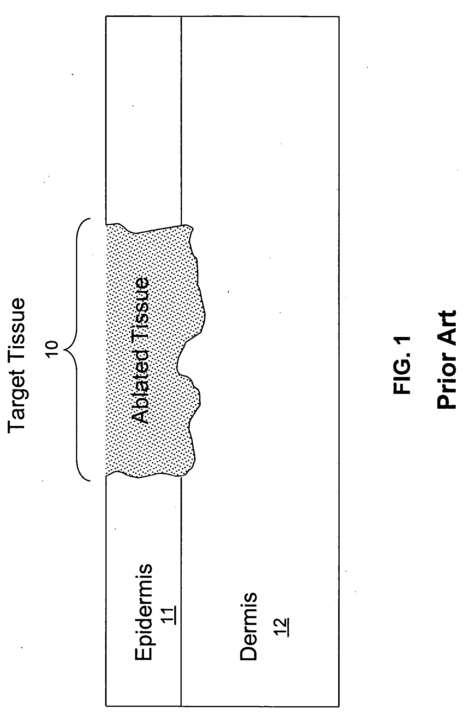Method and apparatus for fractional photo therapy of skin