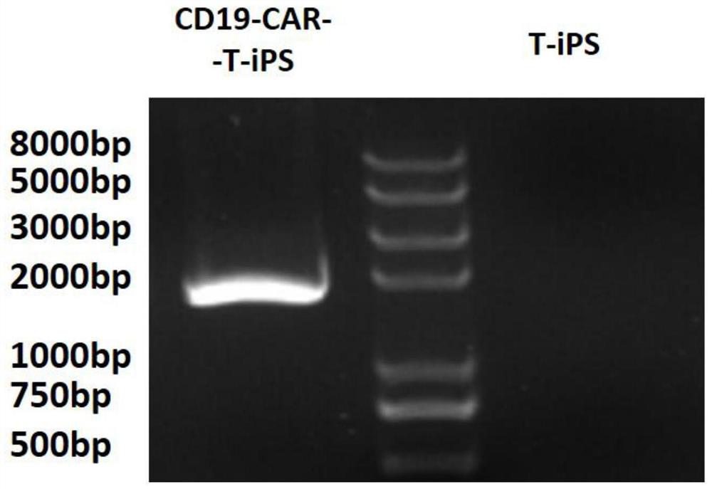 Method for preparing CD19-targeted chimeric antigen receptor NK cells from human pluripotent stem cells and application of CD19-targeted chimeric antigen receptor NK cells