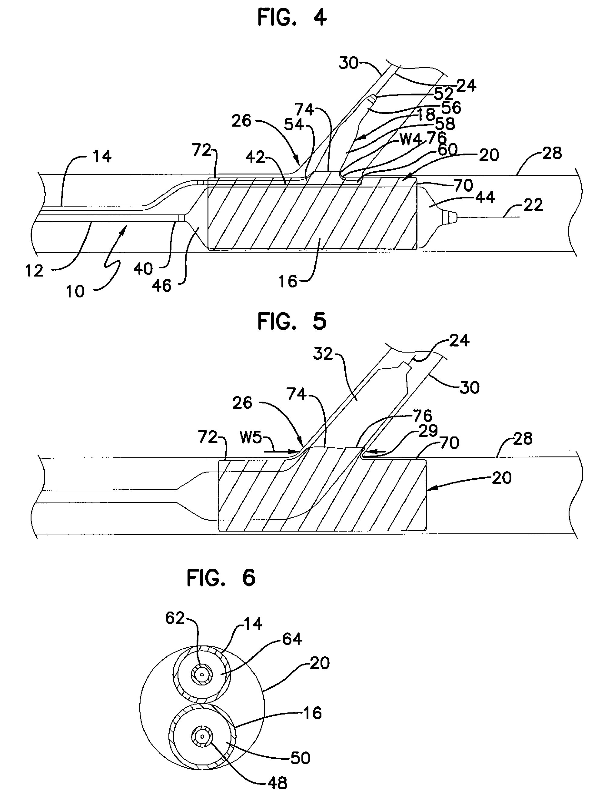 Bifurcation stent delivery system and methods
