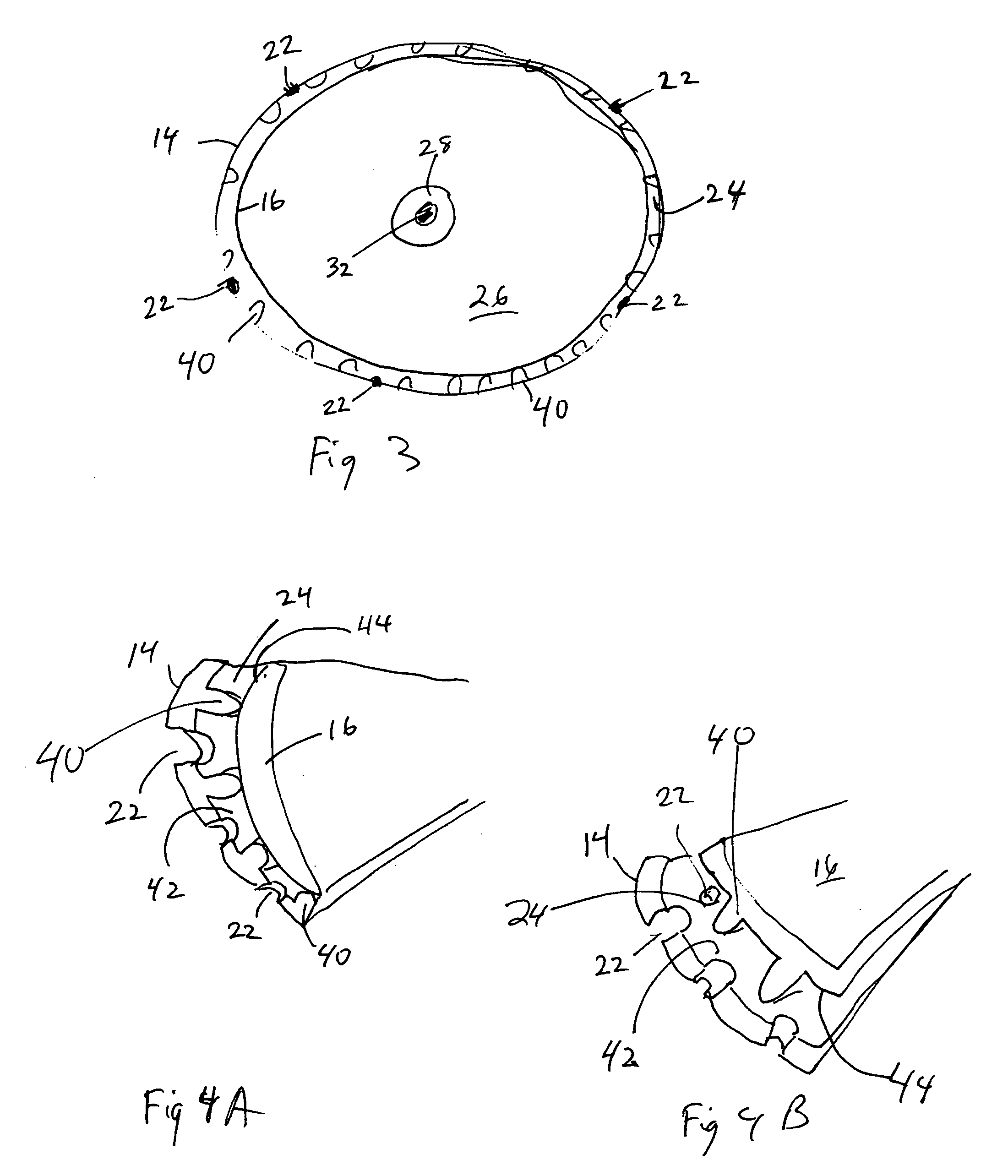 Vacuum device and method for treating tissue adjacent a body cavity