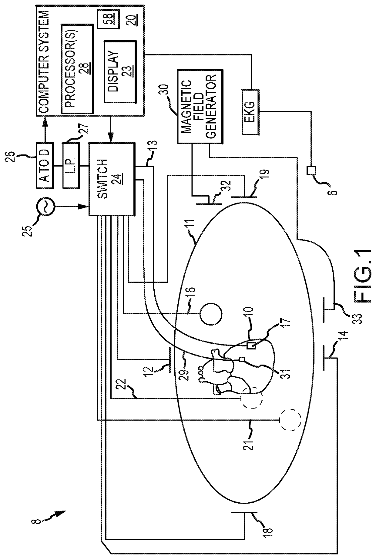 System and method for cardiac mapping