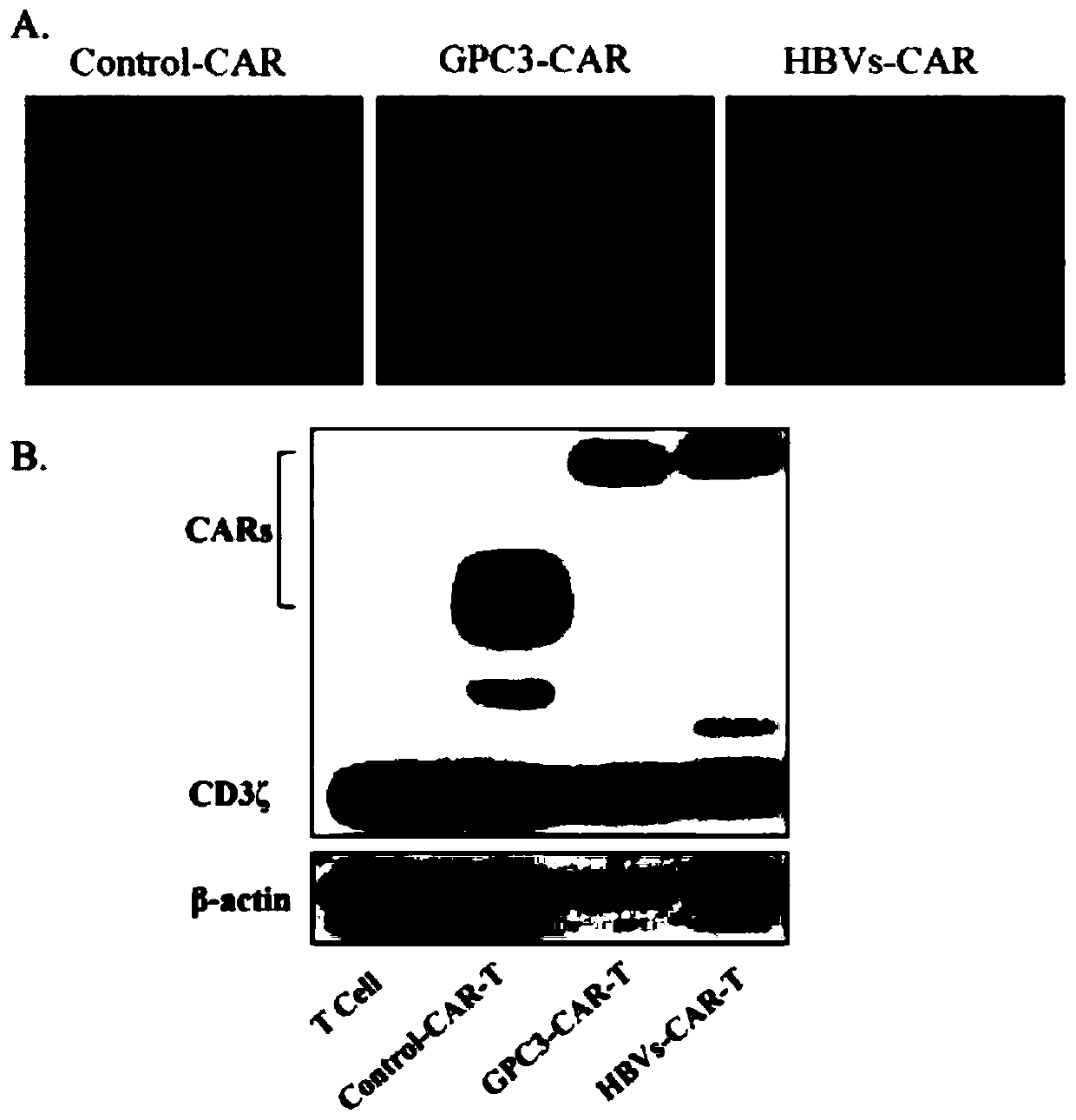 CAR-T in treatment of hepatocellular carcinama by targeting HBV and application thereof