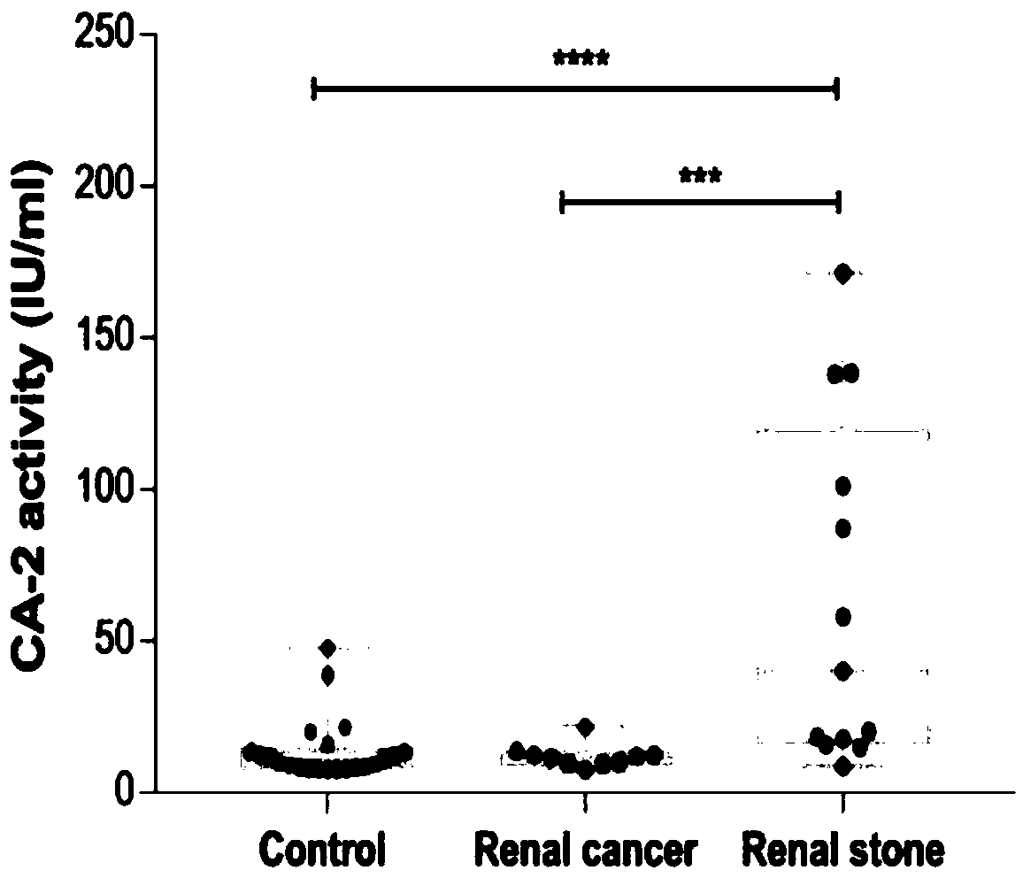 Application of carbonic anhydrase-2 as detection marker in diagnosis of kidney stones