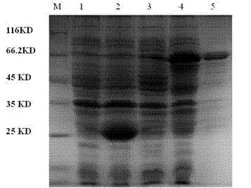 Recombinant strain capable of expressing thermostable Beta-galactosidase and construction method and application