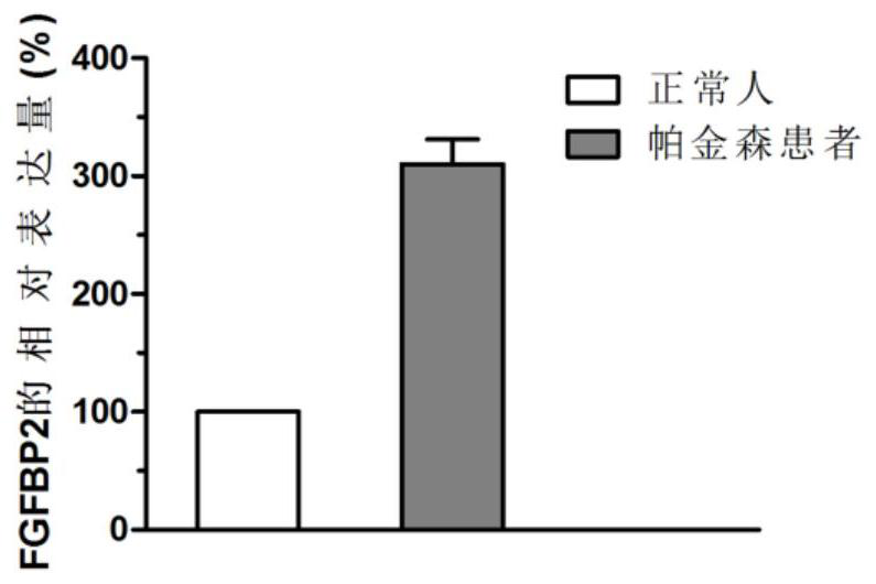 A kind of Parkinson's related biomarker and its application