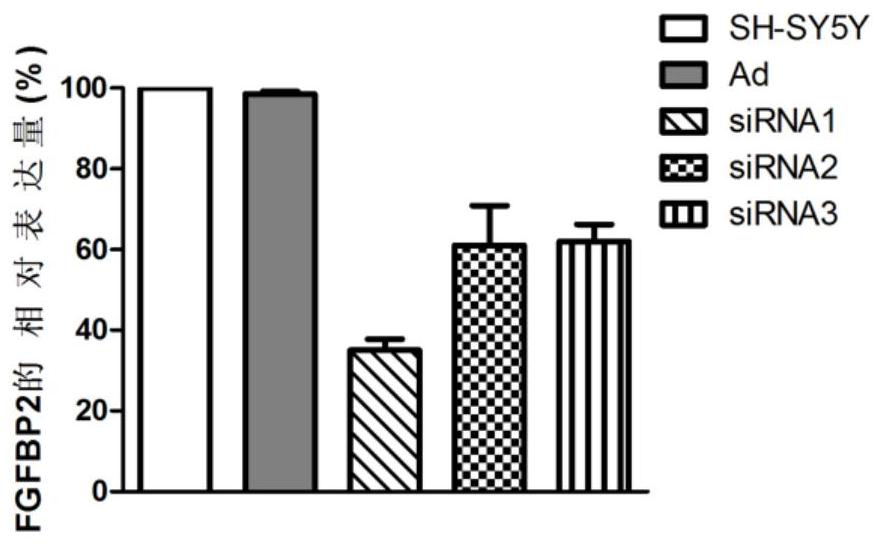 A kind of Parkinson's related biomarker and its application