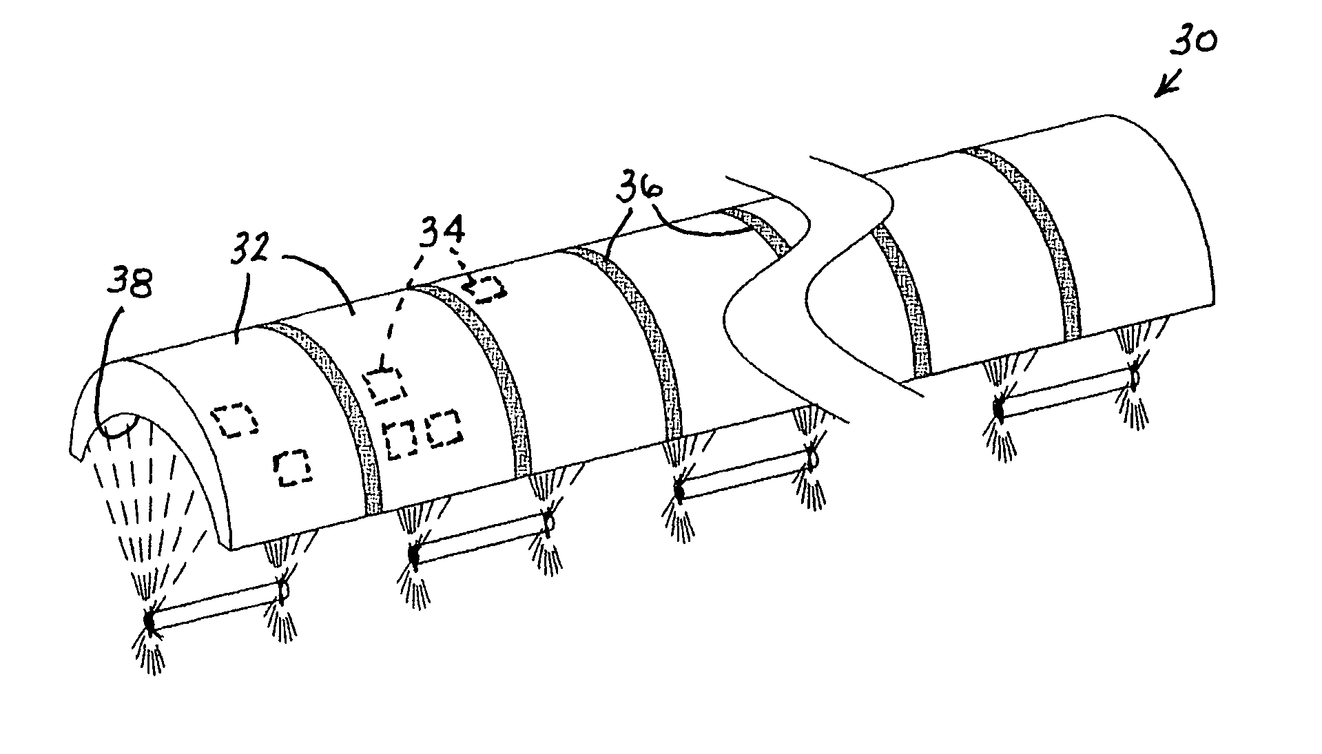 Ultrasonic medical treatment device with variable focal zone