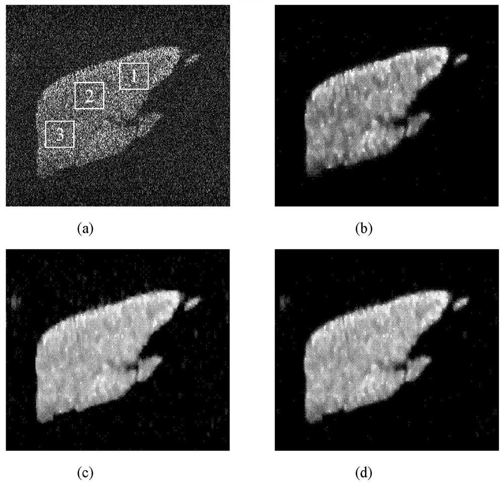 SAR imaging method based on non-convex total variation regularization