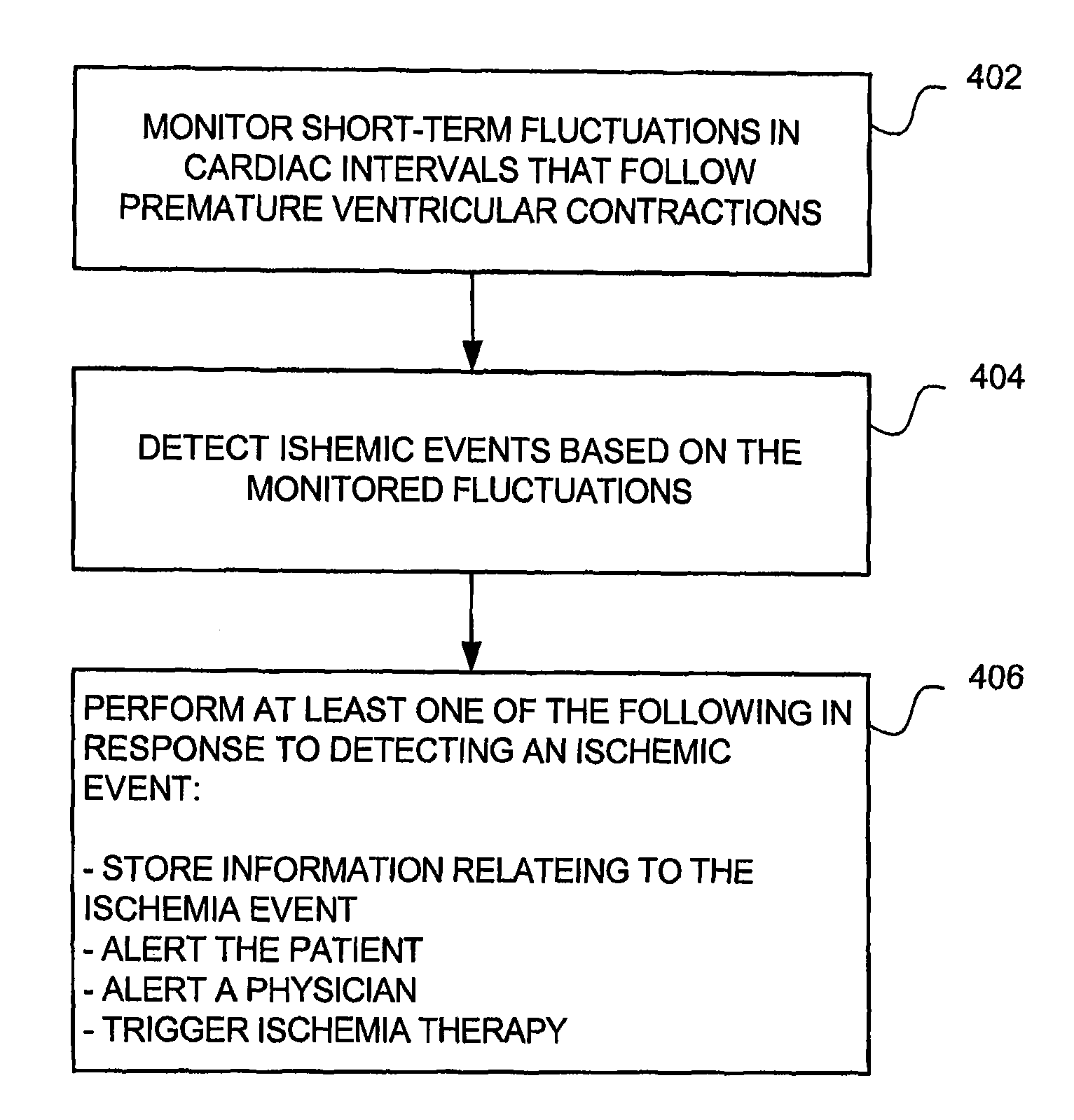 Systems and methods for detecting ischemic events