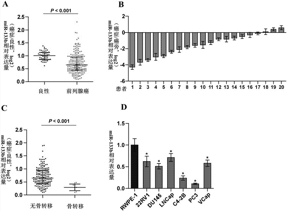 Application of miR-133b in diagnosing, forecasting and treating prostate cancer with osseous metastasis