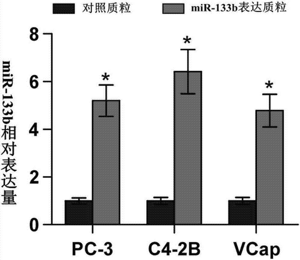 Application of miR-133b in diagnosing, forecasting and treating prostate cancer with osseous metastasis