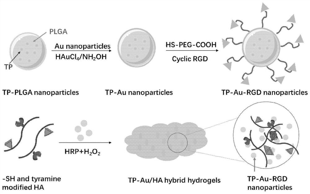 Triptolide-gold nanoparticle/hyaluronic acid composite hydrogel as well as preparation and application thereof