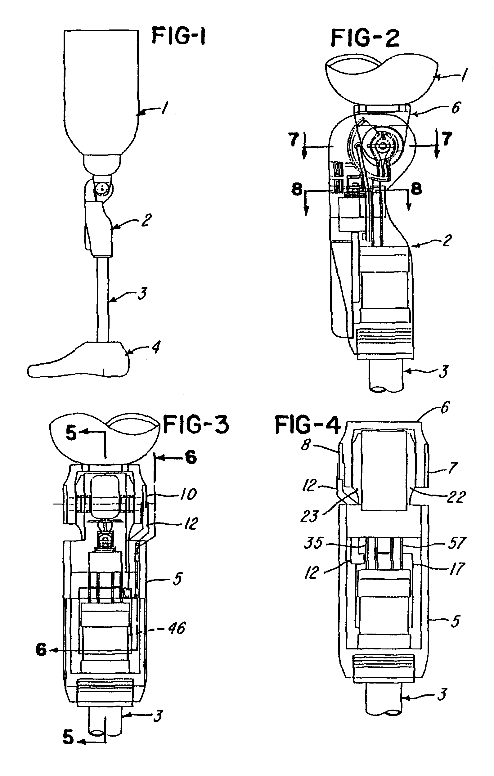 Computer controlled hydraulic resistance device for a prosthesis and other apparatus