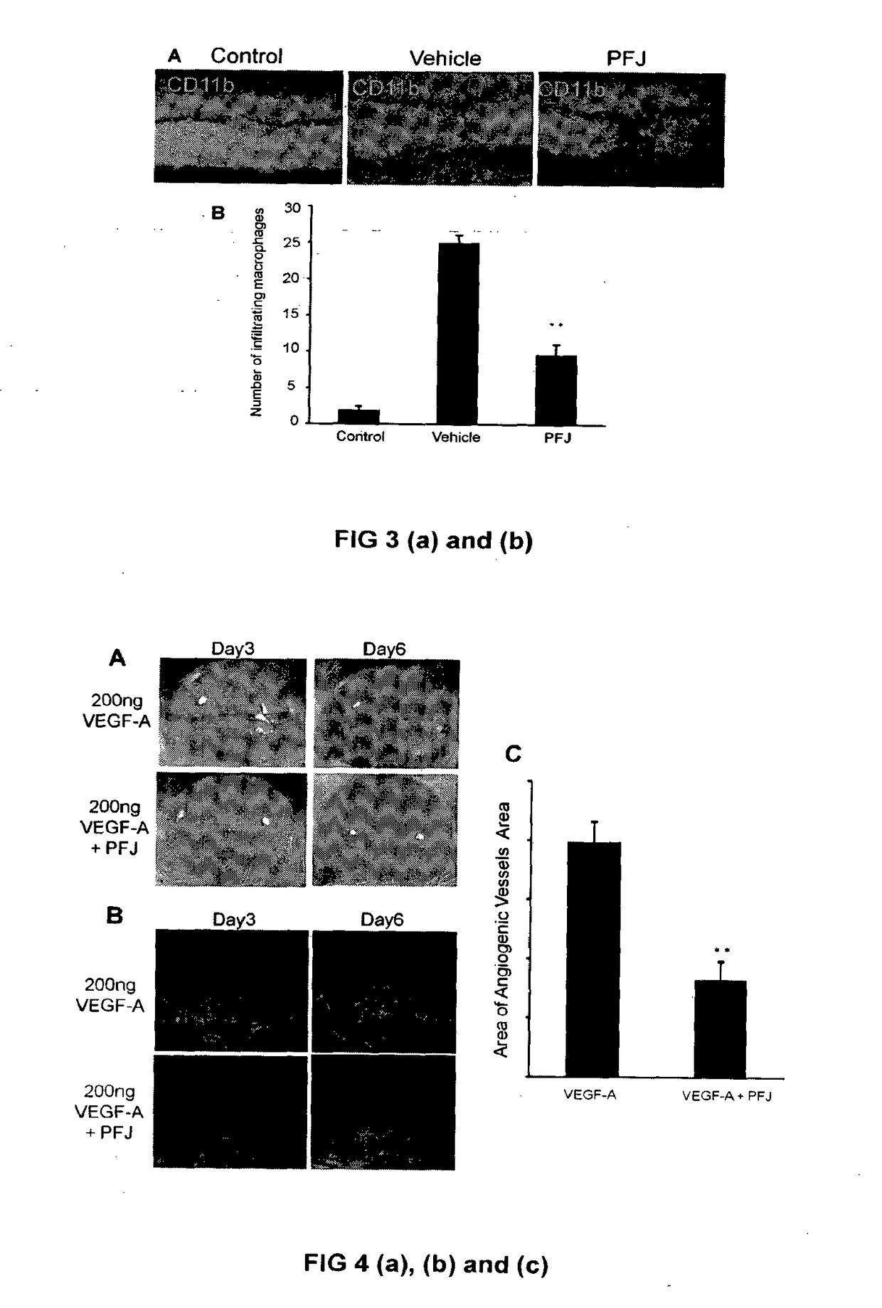 Compositions comprising extracts or materials derived from palm oil vegetation liquor for inhibition of vision loss due to angiogenesis and method of preparation there