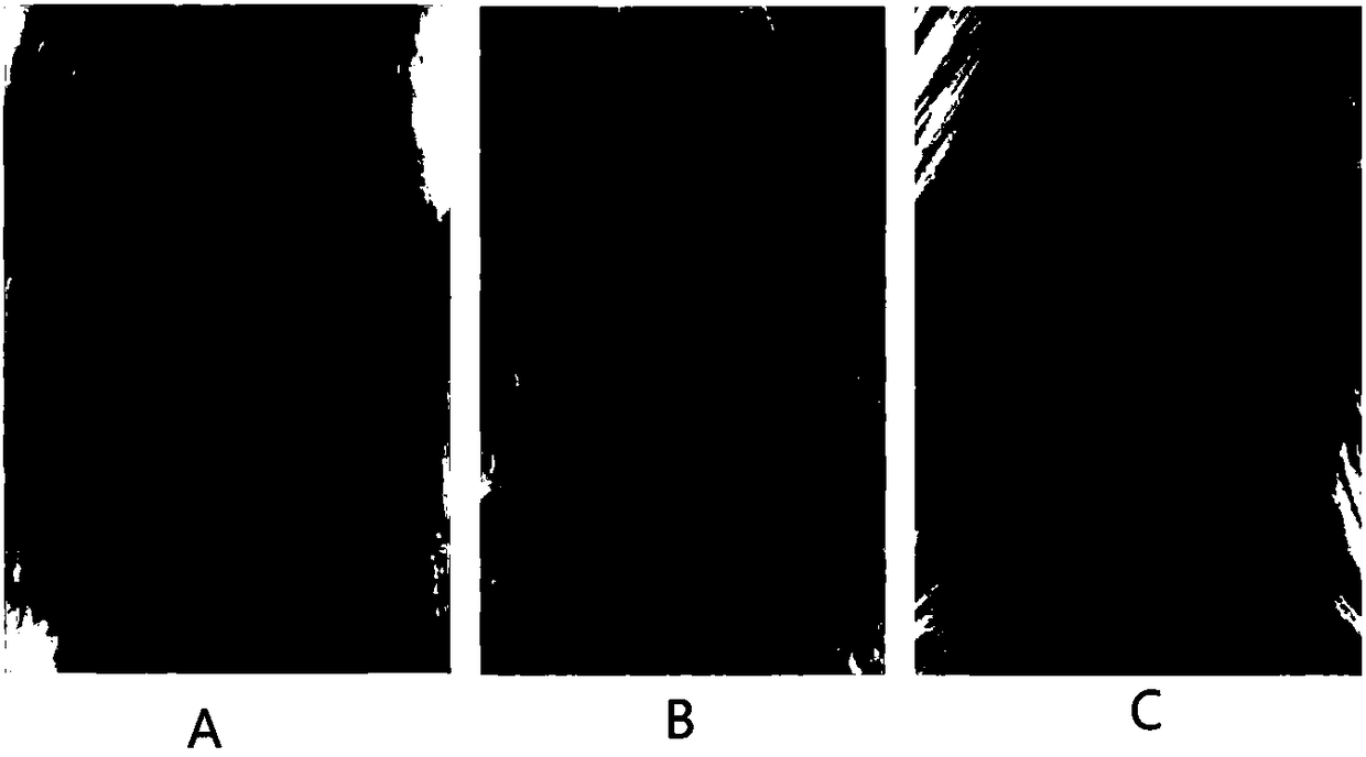 Application of gemcitabine in preparing drug for treating psoriasis, drug and preparation method thereof