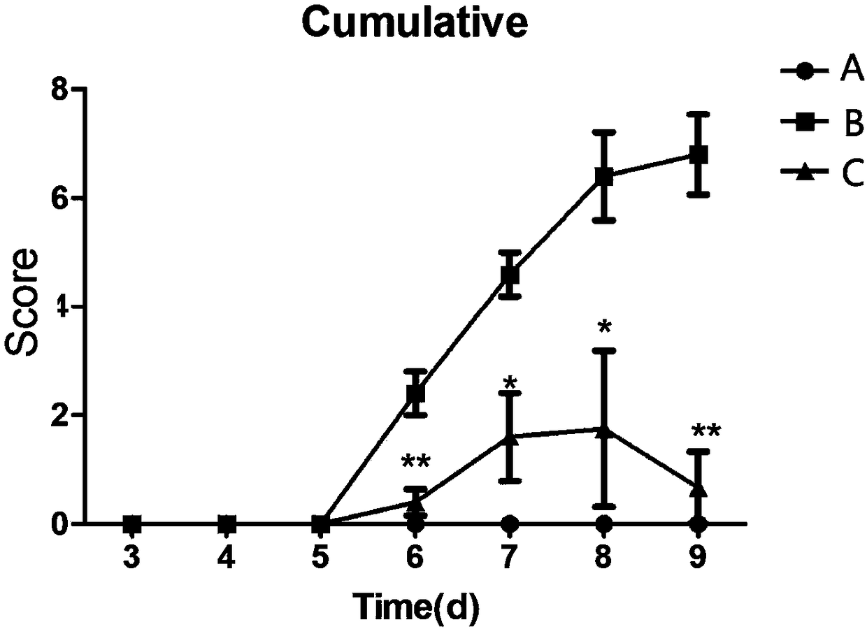 Application of gemcitabine in preparing drug for treating psoriasis, drug and preparation method thereof