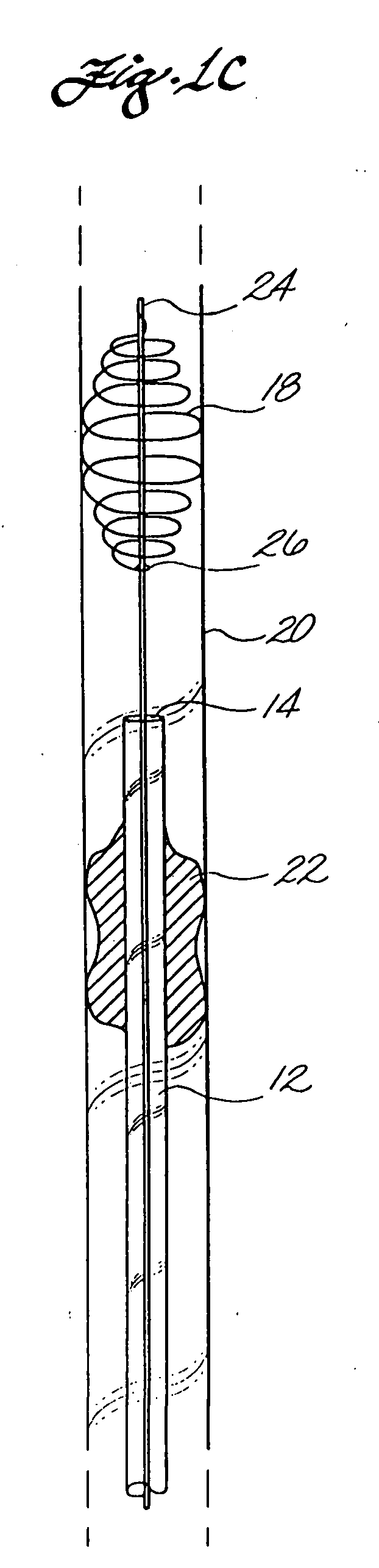 Clot capture coil and method of using same