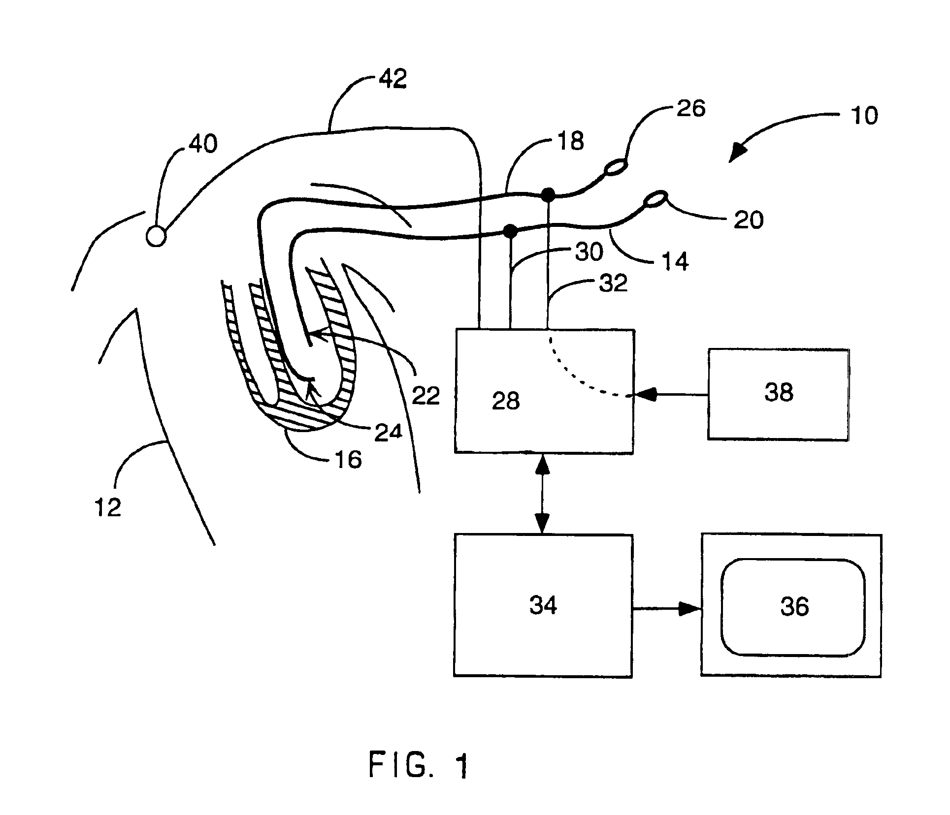Interface system for endocardial mapping catheter