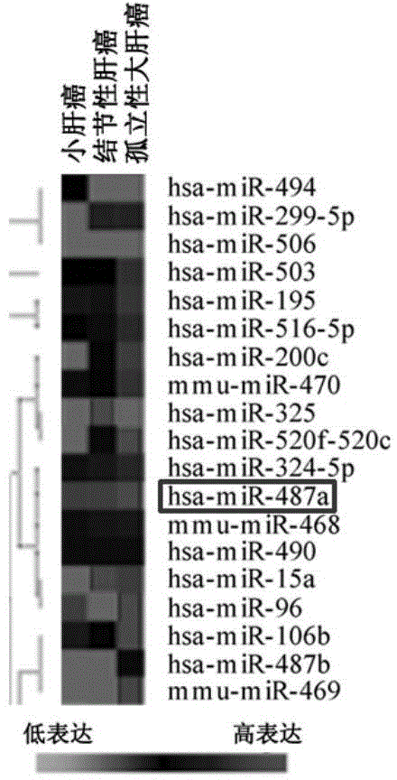 Application of hsa-miR-487a in preparing medicine for treating hepatocellular carcinoma or for postoperative prevention of hepatocellular carcinoma