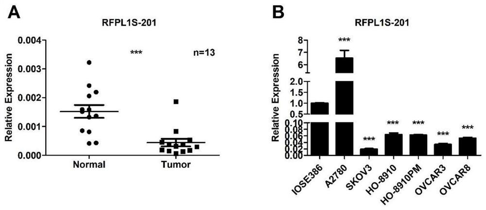 Application of RFPL1S-201 in preparation of drugs for inhibiting proliferation, invasion and/or metastasis of ovarian cancer