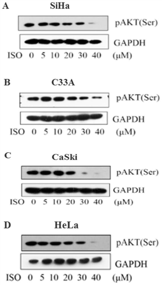 Application of isoliensinine in the preparation of drugs targeted to inhibit akt activation