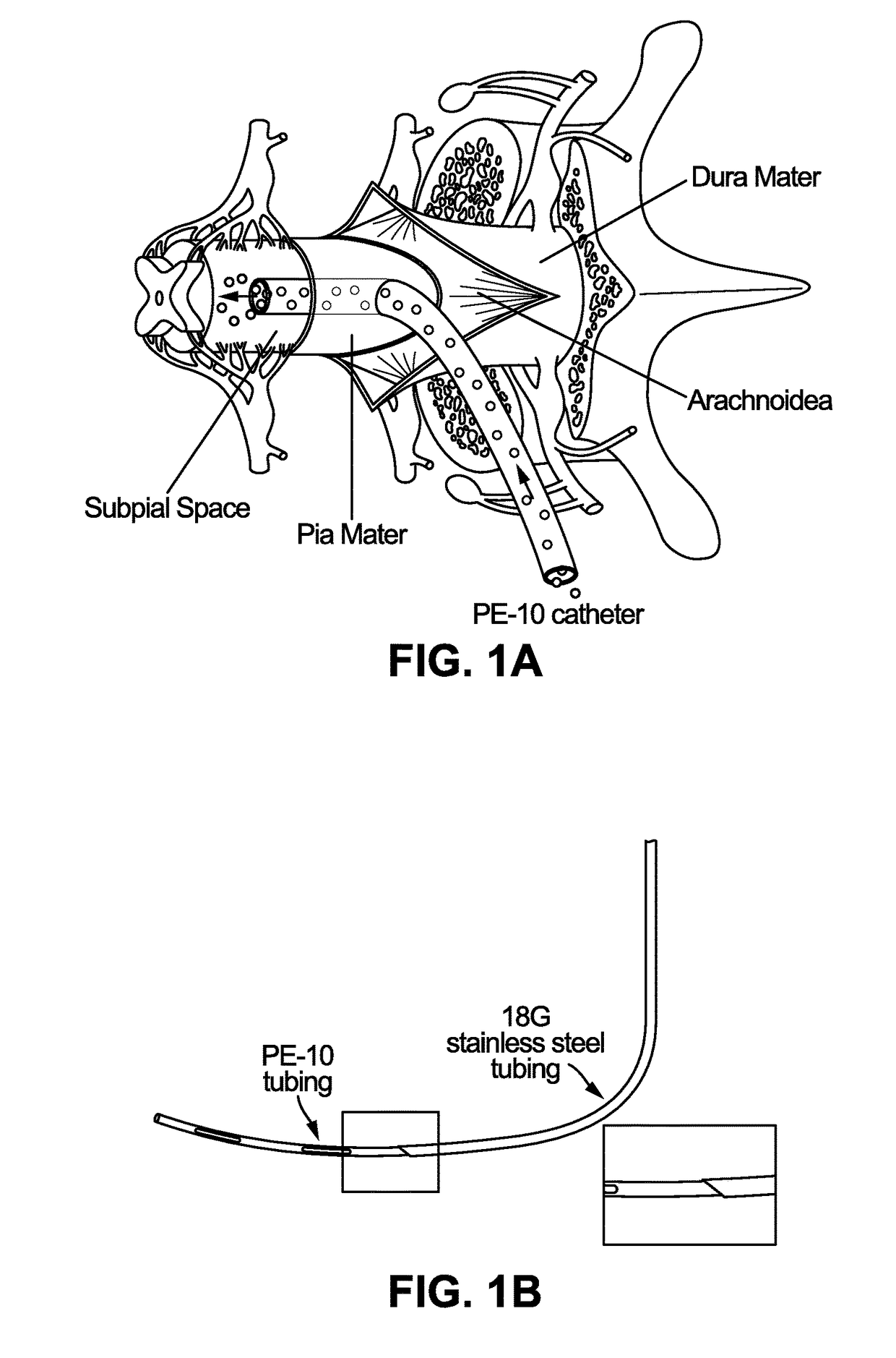 Spinal subpial gene delivery system