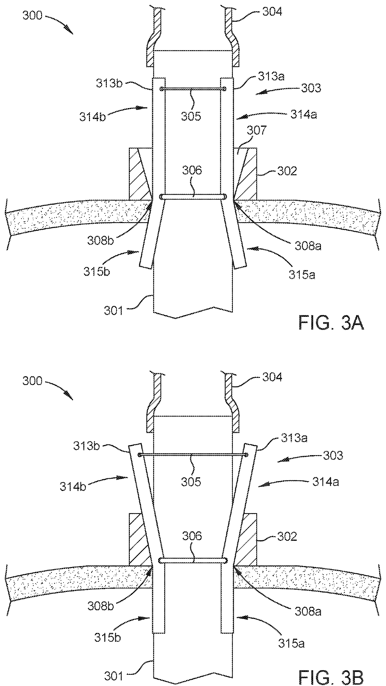 Cannula system with retention feature