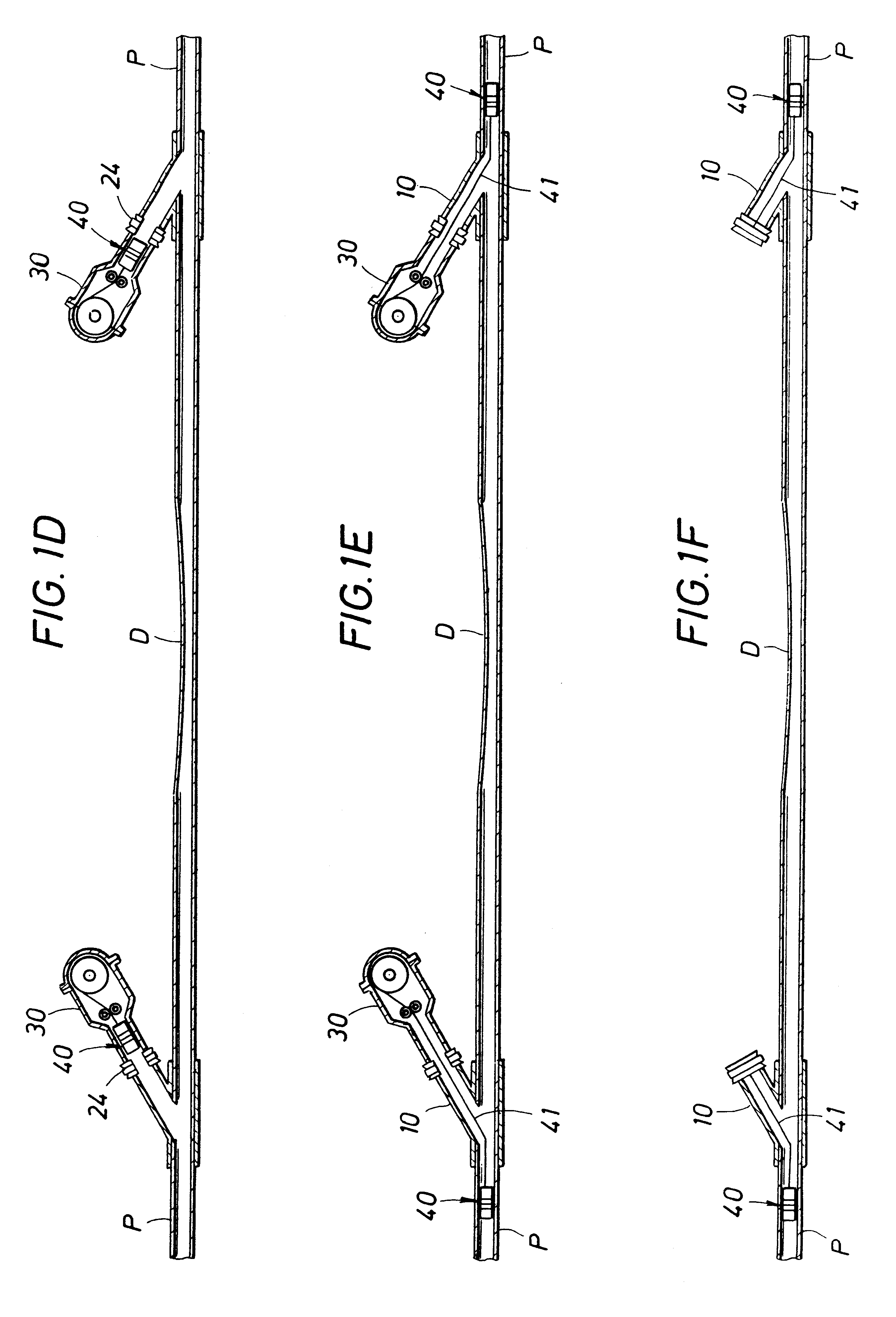 Method and apparatus for replacing damaged section of a subsea pipeline without loss of product or entry of seawater